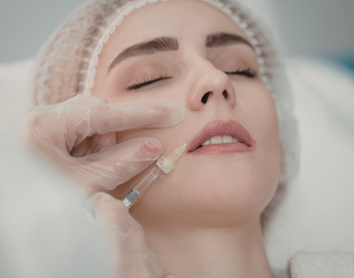 how long do lip fillers last after first treatment